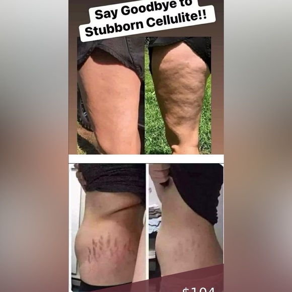 3 TUBES! AgeLOC Dermatic Effects Nuskin - Picture 11 of 16